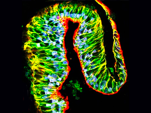 una cavitat revestida de cèl·lules fluorescents amb diversos colors i la vora de color roig