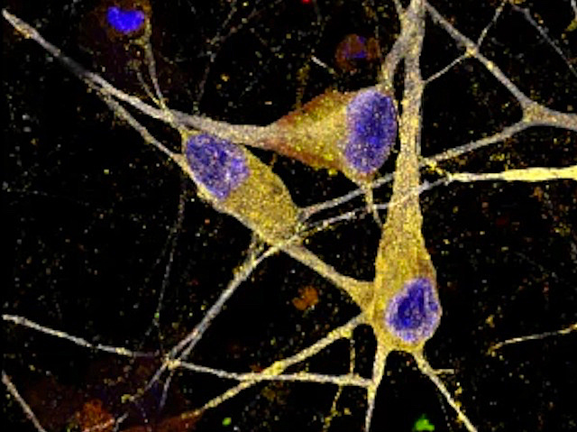 Neurones grogues amb nuclis morats sobre un fons negre
