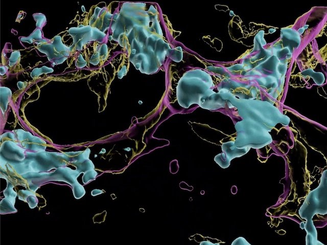 filaments rosa formant una xarxa 3D i cèl·lules blaves associades a ells