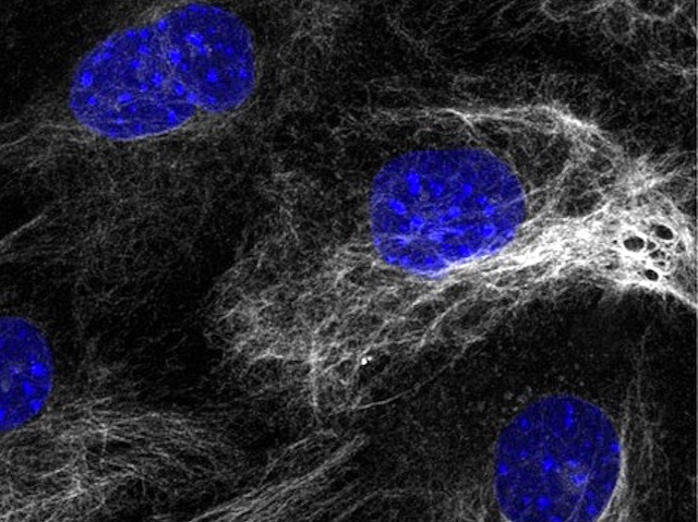 cèl·lules amb les xarxes de citoesquelet de color blanc sobre un fons negre i nuclis cel·lulars blaus