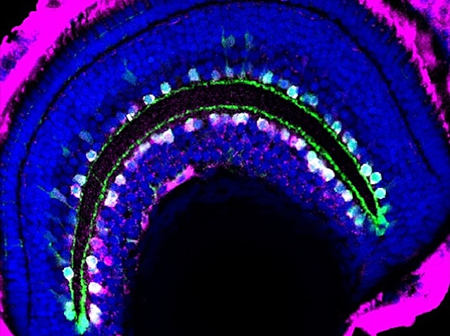 Una retina de color blau i, dins, unes cèl·lules de color blanc