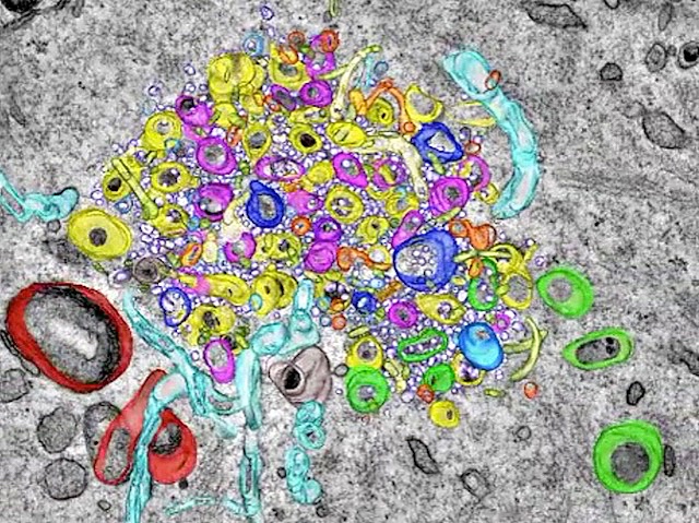 un mosaic de vesícules de diferents colors a l'interior d'una cèl·lula