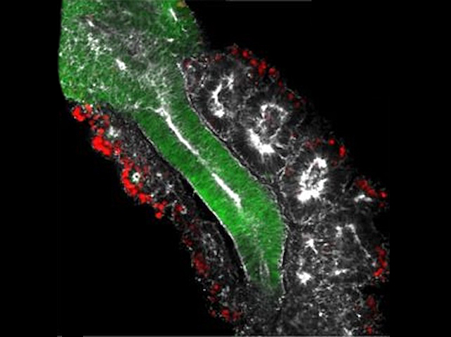 Un paquet de cèl•lules verdes allargat (tub neural) i altres paquets circulars als 2 costats (somites)
