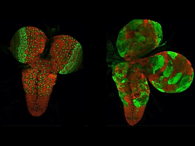 Cervell de la mosca del vinagre amb zones tenyides de roig o de verd, intercalades