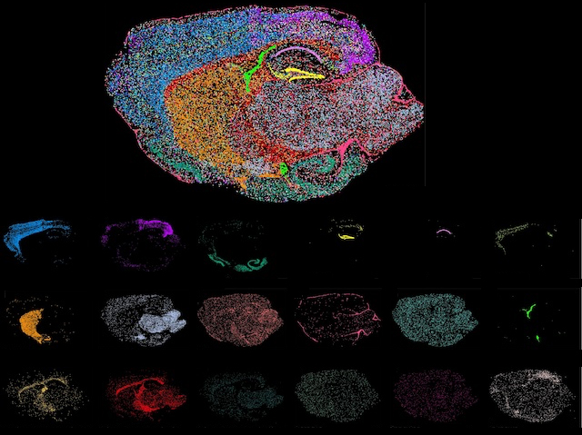 Diferents panoràmiques del mateix cervell de ratolí amb marcatges i colors diferents