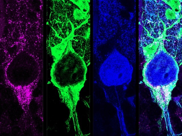 4 imatges d'una cèl•lula: 3 anb tincions diferents i una amb la superposició de les tres