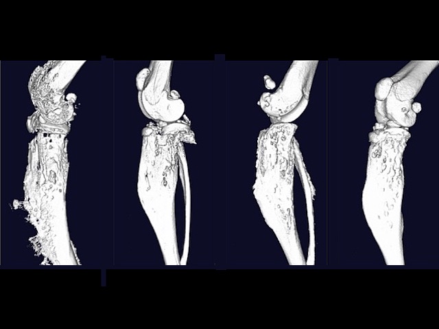4 imatges d'una articulació, mostrant els ossos en blanc i negre
