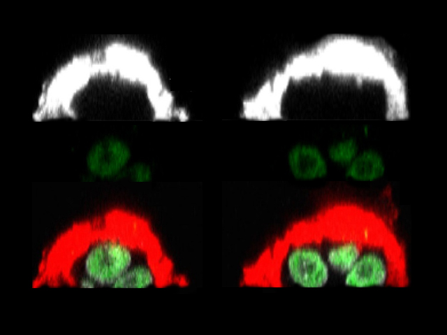 Comparativa de talls d'embrioides amb i sense el factor de transcripció OCT4, marcats amb fluorescència (en roig, blanc i verd)