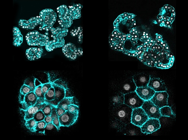 quatre fotos de cèl·lules que tenen el nucli blanc i la perifèria blava