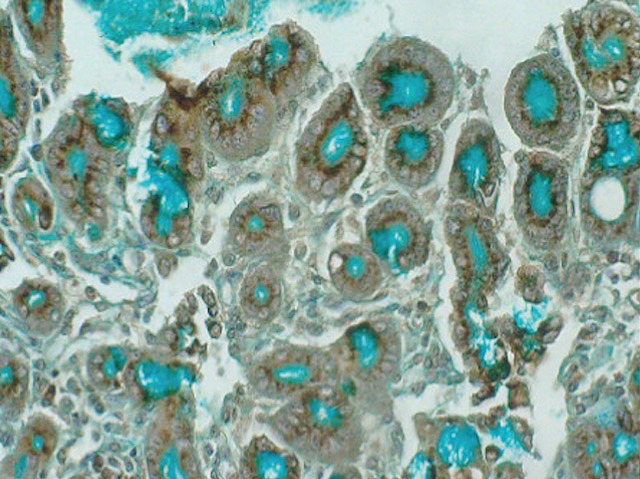 seccions circulars o ovalades de teixit intestinal que tenen la part interna blava