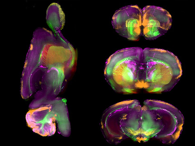 un tall longitudinal  i tres talls transversals de cervell, amb elements marcats amb colors que es veuen en tots els talls (estan connectats o són el mateix element)