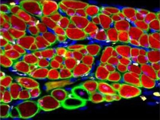 S'aprecien cèl·lules múscul esquelètic amb microscopi de fluorescència, marcades en roig i verd