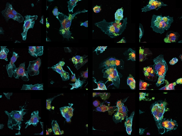 Diferents imatges d'una preparació amb macròfags vista sota microscòpia de fluorescència.