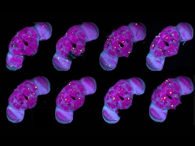 8 estructures iguals trimèriques amb un forat enmig de la forma central. Les 8 estan tenyides amb colorant violeta i presenten uns punts grocs brillants