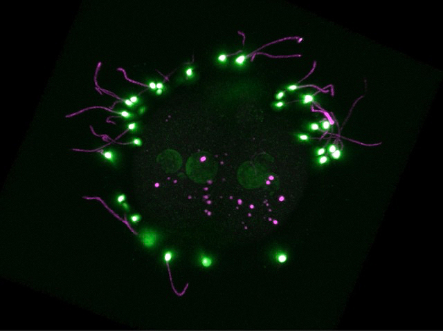 un cercle que té tres petits cercles al centre i al voltant ovals més petits encara amb linies ondulades de color morat