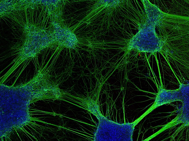 Xarxes de color verd que connecten diverses molècules de color blau.