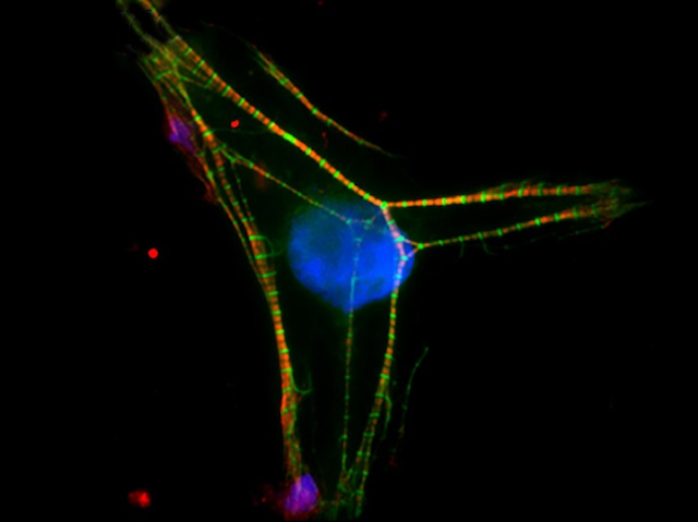 Estructura triangular de filaments amb un nucli central blau