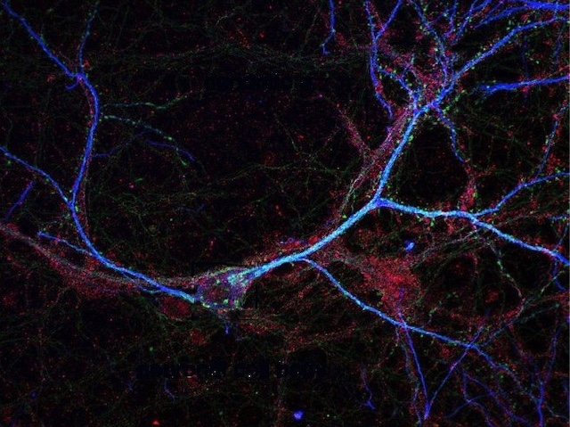 Distribució endògena de NTSR1 en neurones madures de l'hipocamp en cultiu