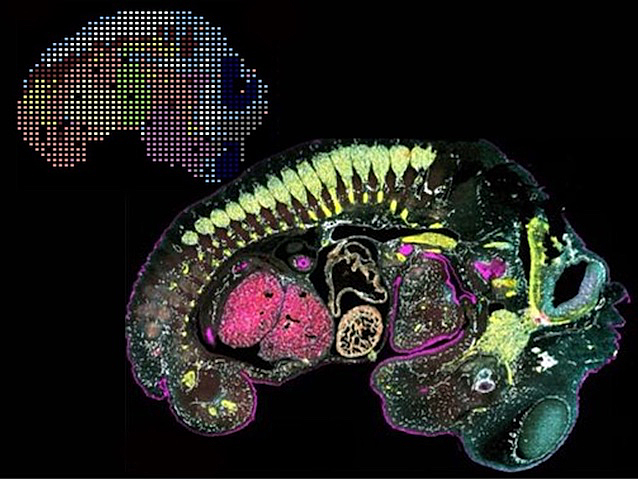 Fotografia al microscopi d'un embrió de ratolí amb tinció fluorescent de diferents òrgans i teixits