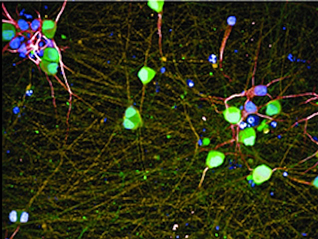 neurones amb el soma verd, amb múltiples ramificacions cel·lulars de color marró i alguna roja