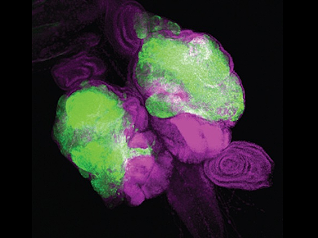 Tumor desenvolupant-se a la mosca del vinagre