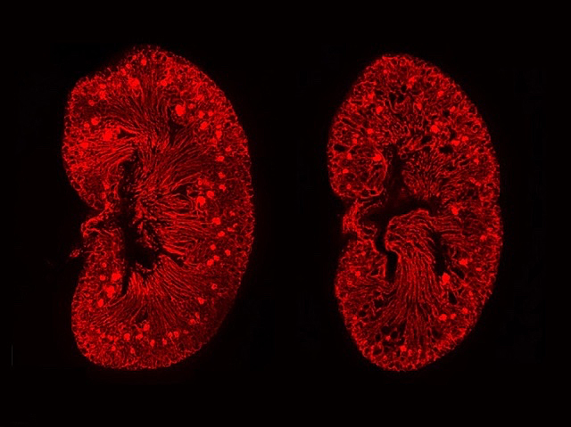 Dues mostres de ronyons a microscòpia en els quals es visualitzen en roig els vasos sanguinis microscòpics en forma de xarxes