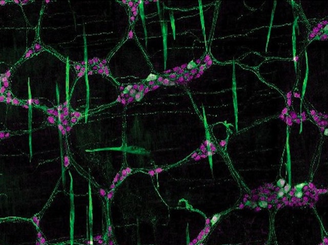 Imatge de microscòpia de neurones en verd i fúcsia formant una xarxa