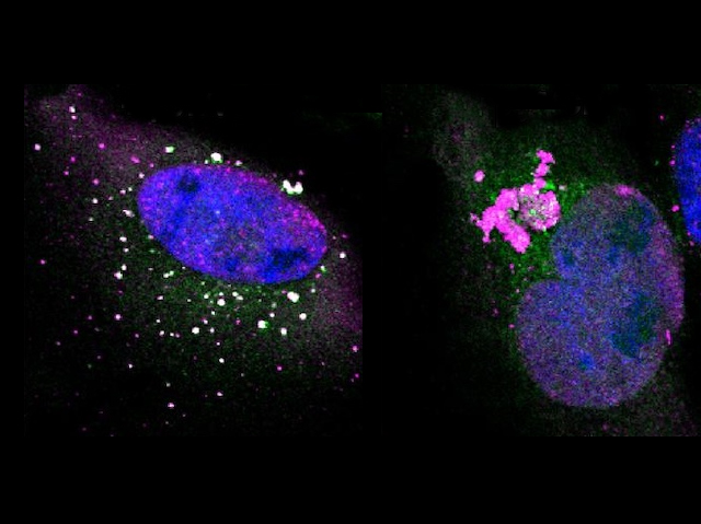 Imatge microscòpica d'enzims tenyits de color rosa