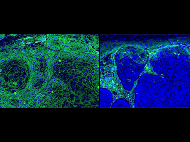 Observació de cèl·lules escaostes (esquerra) i basals (dreta) sota un microscopi de fluorescència