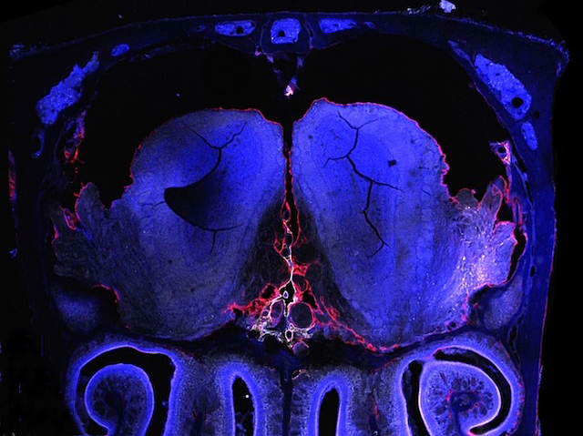 Imatge de l'interior del cervell