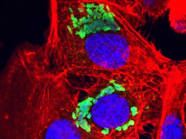 Diverses cèl·lules amb un entramat roig, nuclis redons de color blau brillant i agrupacions verdes al voltant dels nuclis