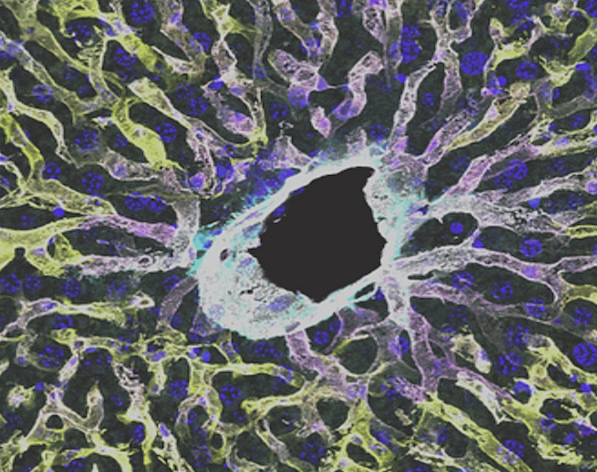 Entramat de filaments que ixen des de la perifèria d'un cercle negre central. També s'observen cercles blaus de menor diàmetre, entre els filaments.