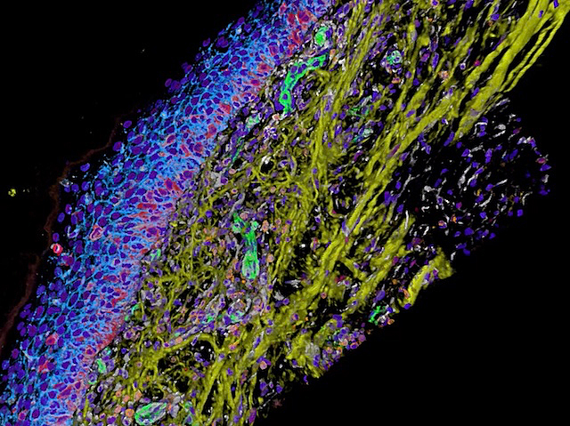 Mostres de teixit examinades amb el mètode d'immunofluorescència cíclica d'alta plexitat
