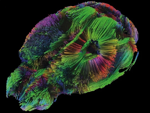 una estructura ovalada que està plena de grups de filaments de diferents colors i orientats de manera desigual