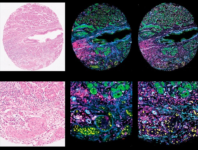 la primera columna té un teixit amb tons rosa i morat, les altres dos columnes té el mateix teixit amb múltiples colors