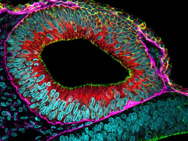 un teixit ovalat de colors blau i roig, amb una cavitat central