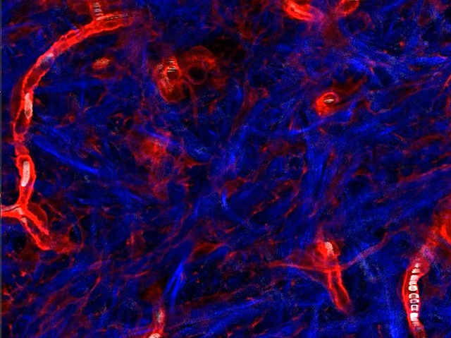 sobre un fons blau i fibrós es veuen algunes cèl·lules roges